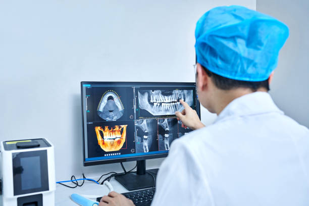 Best Emergency Tooth Extraction in Santa Cruz, CA